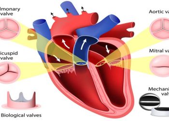 Valvular-heart-disease