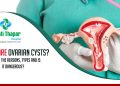 What-are-ovarian-cysts-What-are-the-reasons,-types-and-is-it-dangerous