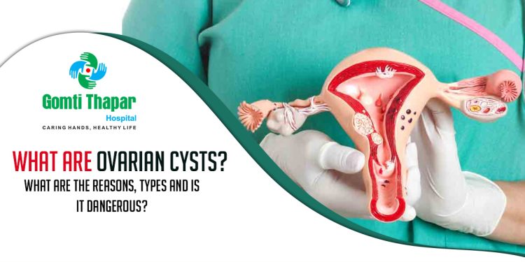 What-are-ovarian-cysts-What-are-the-reasons,-types-and-is-it-dangerous
