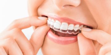 orthodontists in Chino Hills CA