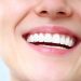 best teeth whitening clinic in dubai