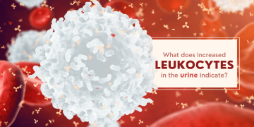 increased leukocytes in the urine indicate