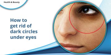 causes of dark circle under eyes