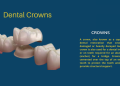 teeth crown service near me